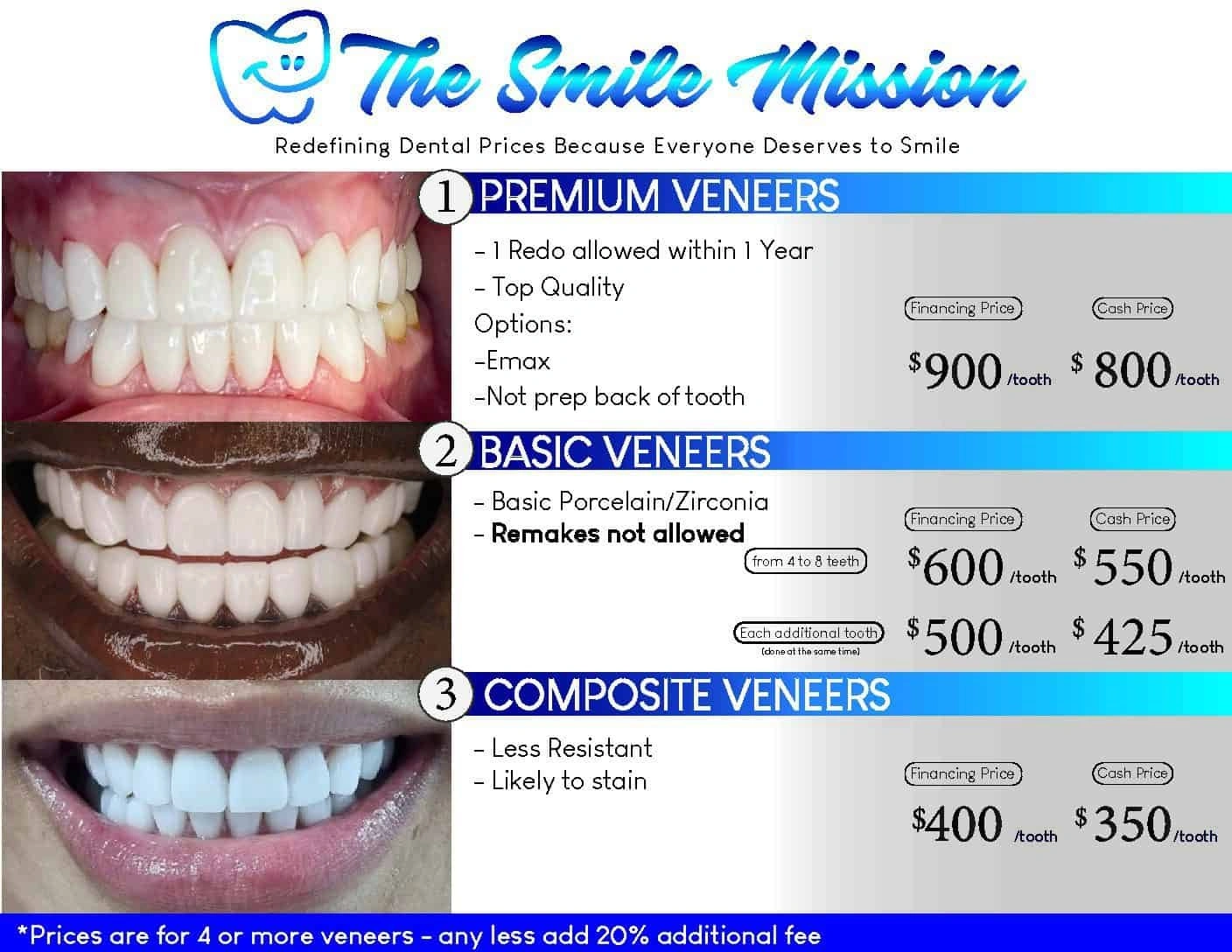 Veneers Cost Per Tooth: What You’ll Really Pay in 2025