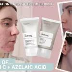 Vitamin C Before Azelaic Acid: Best Order Guide
