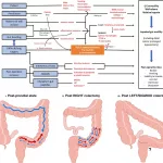 Managing Weight Loss After Right Hemicolectomy