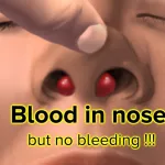 What Does Blood Smell Like in Your Nose?