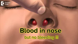What Does Blood Smell Like in Your Nose? Real Talk on That Strange, Metallic Whiff