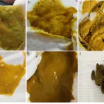 What Does C Diff Poop Look Like? Let’s Talk Real Talk (Not Just Symptoms!) What Does C Diff Poop Look Like? Let’s Talk Real Talk (Not Just Symptoms!)