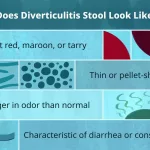 What Does Poop Look Like with Diverticulitis?