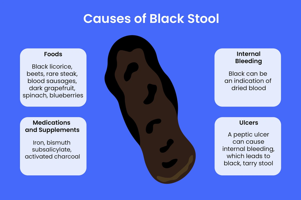 When Should You Worry About Black Stool? An Honest Toilet Talk