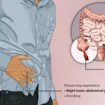 Which is worse appendix or gallbladder surgery?