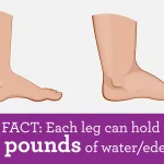 Why Do My Legs Feel Heavy and Weak?