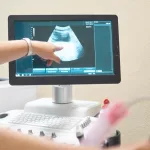 16 Week Ultrasound: What to Expect