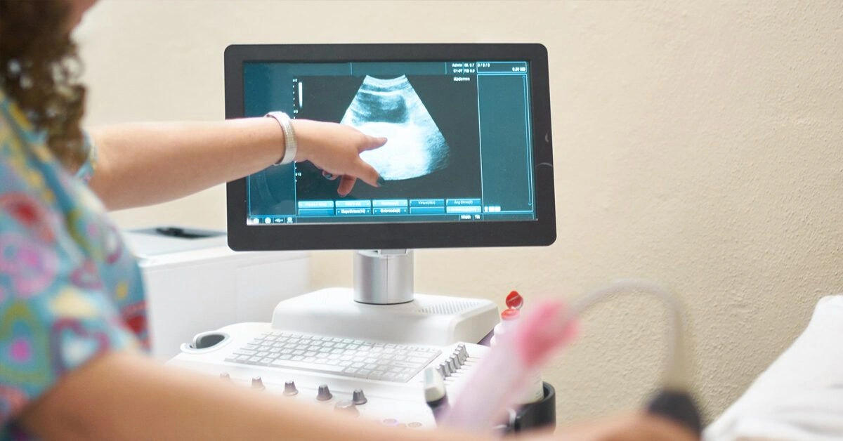 What to Expect at Your 16-Week Ultrasound