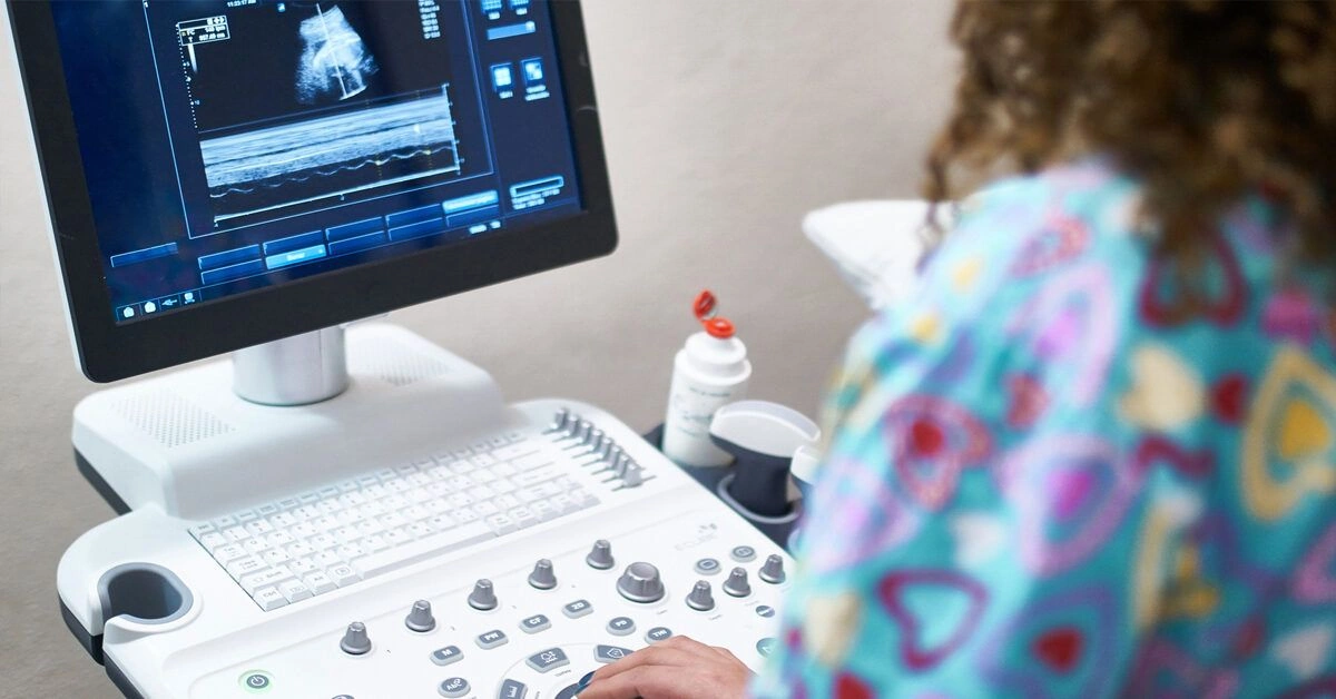 What to Expect at Your 7-Week Ultrasound
