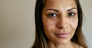 What It Means to Have an Anicteric or Icteric Sclera