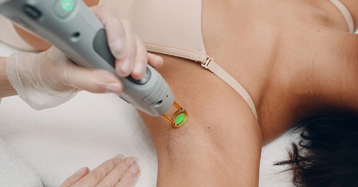All About Armpit Laser Hair Removal