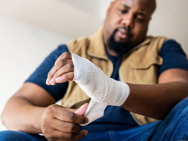 Bandaging Your Hand Following Injury