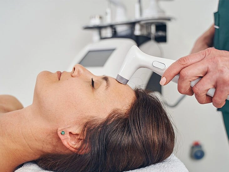 Everything to Know About Laser Skin Tightening
