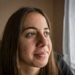 Everything You Want to Know About Laser Treatment for Acne Scars Everything You Want to Know About Laser Treatment for Acne Scars