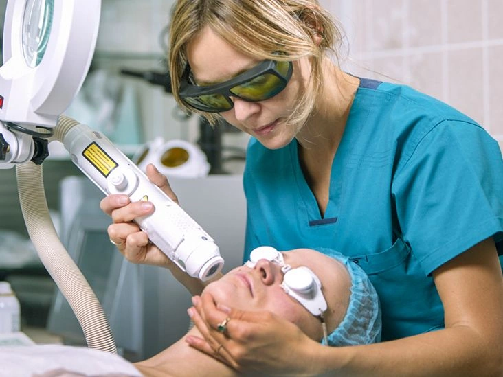 A Guide to Laser Treatment for Rosacea