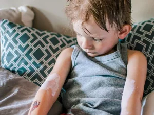 What Bedbug Bites Look Like and How to Get Rid of Them What Bedbug Bites Look Like and How to Get Rid of Them