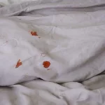 What Causes Bleeding After Being Fingered?