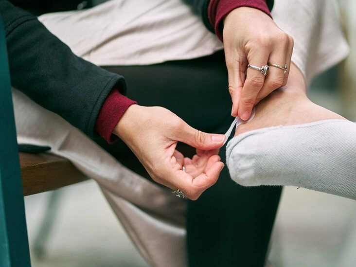 13 Causes of Blisters