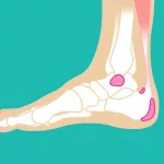 About Ankle Bursitis: What It Is and What to Do About Ankle Bursitis: What It Is and What to Do