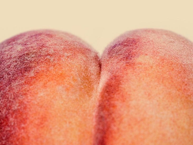 What Causes a Rash on the Butt?