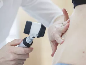 What Is Calciphylaxis?