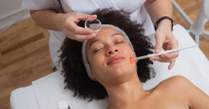 Chemical Peels Before And After Results