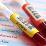 Cholesterol Test (Lipid Panel) Cholesterol Test (Lipid Panel)