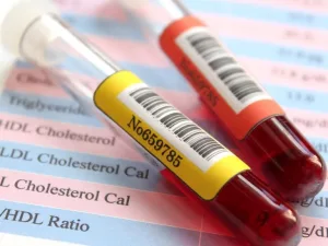 Cholesterol Test (Lipid Panel)