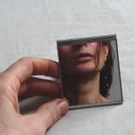 Considering Double Chin Surgery? Know Your Options Considering Double Chin Surgery? Know Your Options