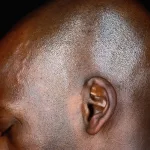 What Could Be Causing the Crackling in Your Ear? What Could Be Causing the Crackling in Your Ear?