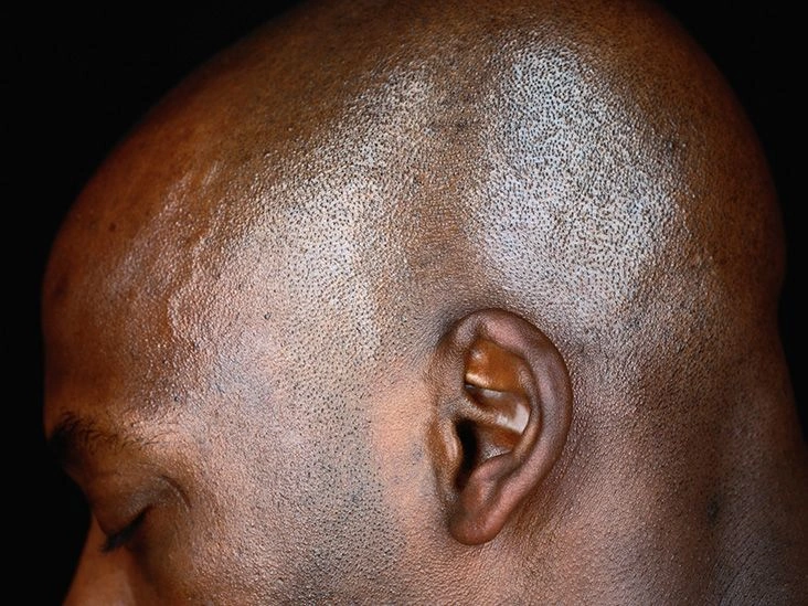 What Could Be Causing the Crackling in Your Ear?
