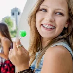 What Causes Crooked Teeth and How to Straighten Them