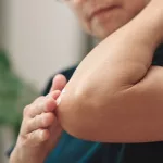 Remedies for Dark Elbows