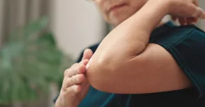 Brighten Dark Elbows Naturally