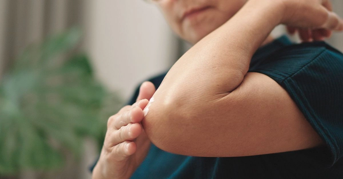 Remedies for Dark Elbows