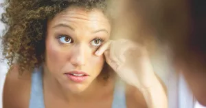 What Causes Dark Eyelids and How Are They Treated?