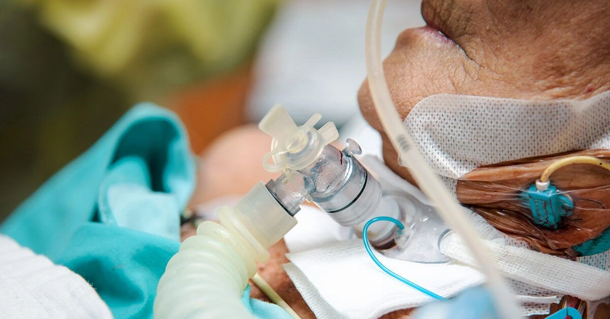 What is Decannulation of a Tracheostomy?