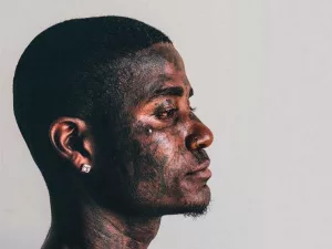 What You Should Know Before Getting a Dermal Piercing What You Should Know Before Getting a Dermal Piercing