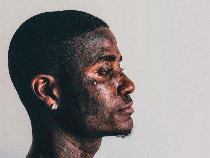 What You Should Know Before Getting a Dermal Piercing