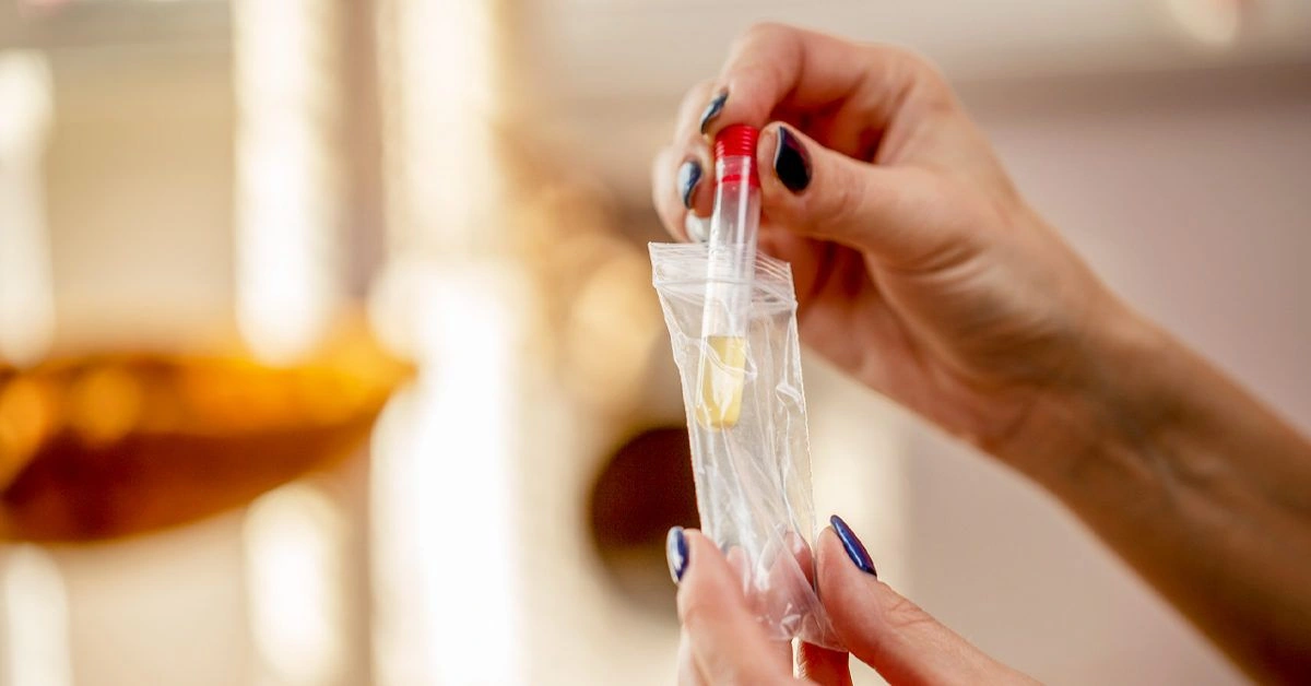 What Causes Diluted Urine in Drug Tests and How to Prevent It