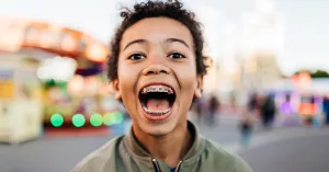 Who Needs Braces?