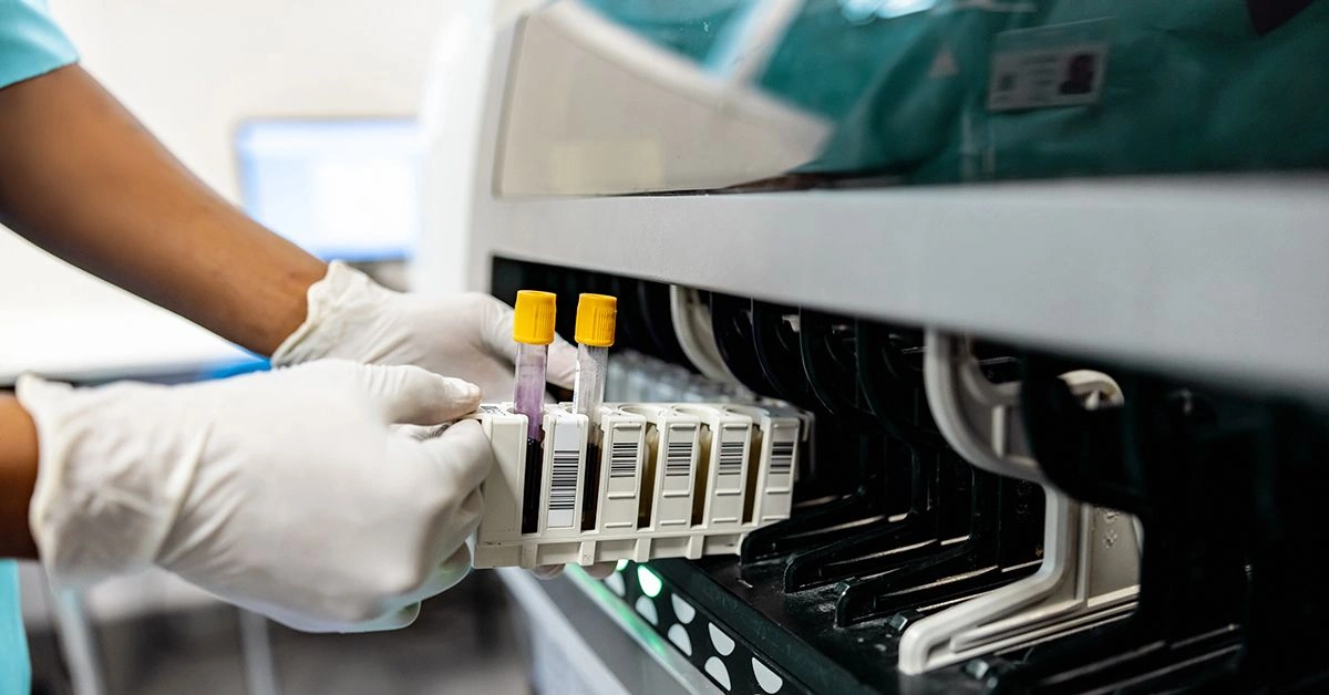 Does Medicare Cover the Prostate-Specific Antigen (PSA) Test?