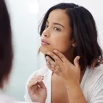 Dry Oily Skin: Managing Combination Skin