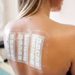 What Is the Patch Test for Contact Dermatitis Allergens? What Is the Patch Test for Contact Dermatitis Allergens?