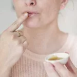 Essential Oils For Cold Sores Relief