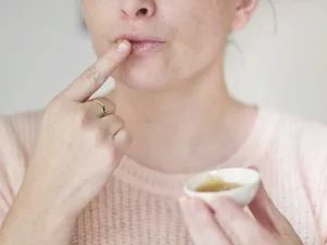 Essential Oils for Cold Sores