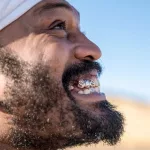 How Does a Gold Crown Stack Up to Porcelain? How Does a Gold Crown Stack Up to Porcelain?