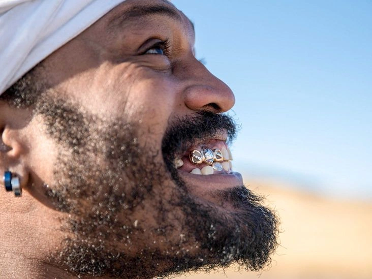 How Does a Gold Crown Stack Up to Porcelain?