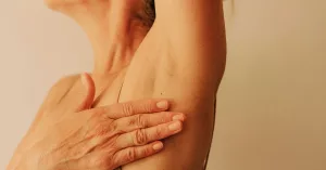 What to Know About Hidradenitis Suppurativa Tunnels