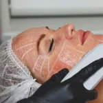 Can High-Intensity Focused Ultrasound Treatment Replace Face Lifts?